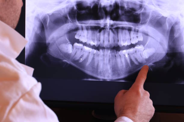 Best Emergency Dental Care for Broken or Chipped Teeth in Ashland, AL